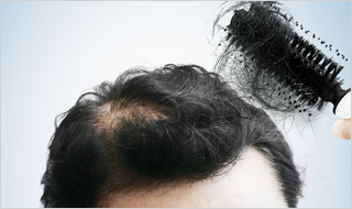hair loss care
